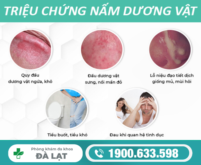 Hình ảnh minh họa